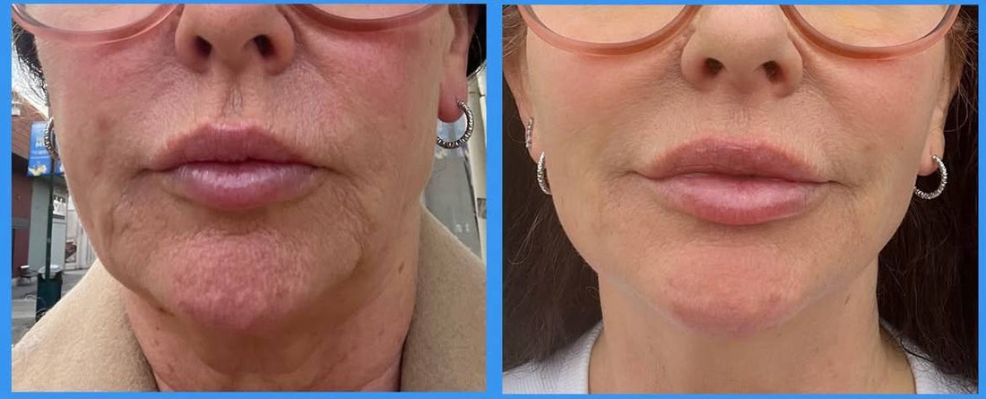 Bleu de Méthylène en Crème : Bienfaits Surprenants pour une Peau Jeune et Protégée